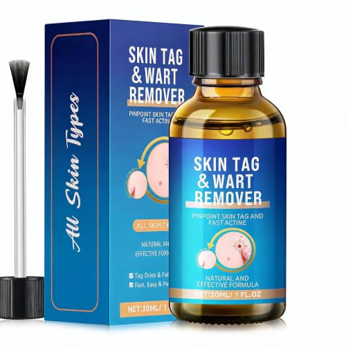 Wart Remover,Fast-Acting Skin Tag & Wart Remover for Feet & Hands,Skin Tag Removal Kit
