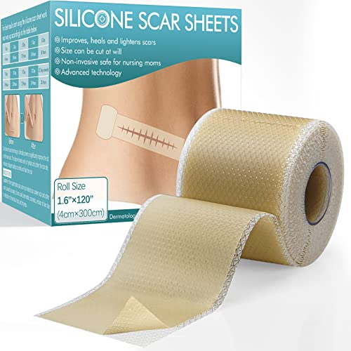 Silikonpflaster für Narben (1,6 x 120 Rolle - 3,0 m), Easy-Tear Silikon-Narbenblätter, Narbensalbe für Narben, die durch Kaiserschnitt, Operationen, Verbrennungen, Keloid usw. verursacht wurden