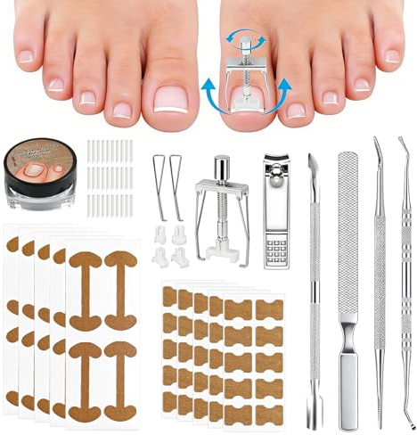 MSLHUB Set de corrección de uñas encarnadas de los pies, set de herramientas sencillo para uñas encarnadas de los pies, grapa correctora para uñas de los pies con parche corrector de uñas, set