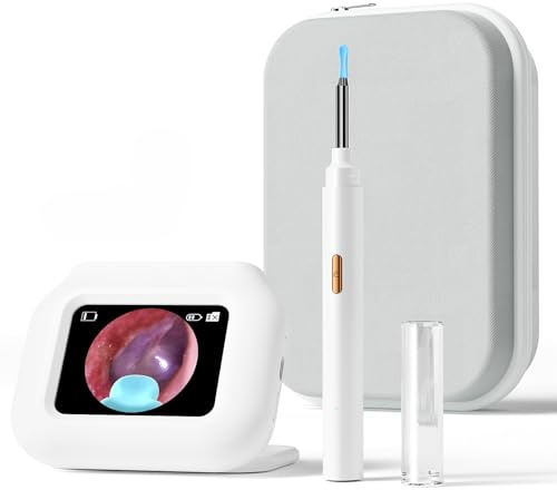 Ear Wax Removal Tool Camera with Screen, Smart Screen Ear Wax Removal Kit with 2.8'' HD Display, WiFi Automatic Connect - Ear Cleaner Tool with Camera&Screen, 6 Replaceable Tips, No App/Phone Needed