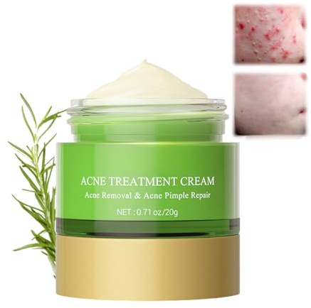 Acne Care Cream for Face with Tea Tree Oil,Fast Acting Spot Solution Gel-Cream to Reduce Blemishes&Breakouts,Shrink Pores&Fade Acne Scars,Gentle Non-Greasy Formula for Sensitive&Oily Skin