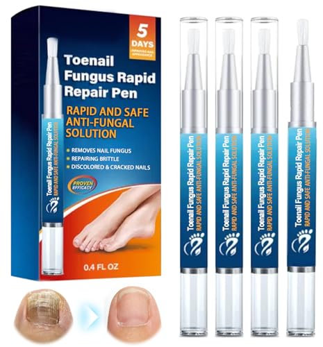 4 Stück Nagelpflegestift,Nagelaufbauserum,Nagelpflegeprodukte,Nägel Reparieren,Nägel nähren Nail Care Pen,Nail Care Renewal & Recovery Liquid für Dicke, Beschädigte & Verfärbte Nägel