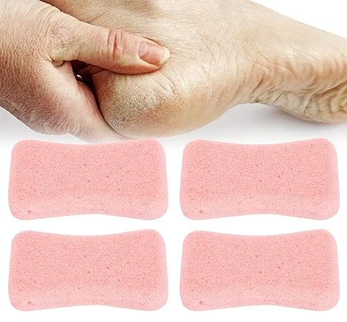 4 pièces soin des pieds pierre ponce exfoliant violet rose bleu orange exfoliant pour les pieds, les mains et le corps(Rose)