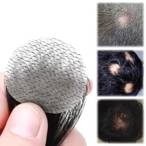 Toupet de Patch de cheveux de tache chauve, unité de remplacement de cheveux naturels de cheveux humains pour la ligne de cheveux d'hommes et de femmes(Natural black,5cm)