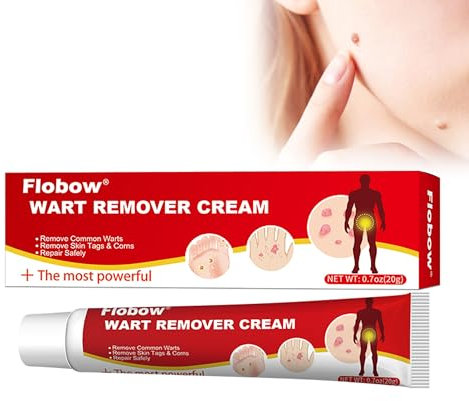 Crema para eliminar verrugas 20 g, kit para eliminar verrugas, callos, lunares y durezas, crema para eliminar lunares en cuerpo y manos.
