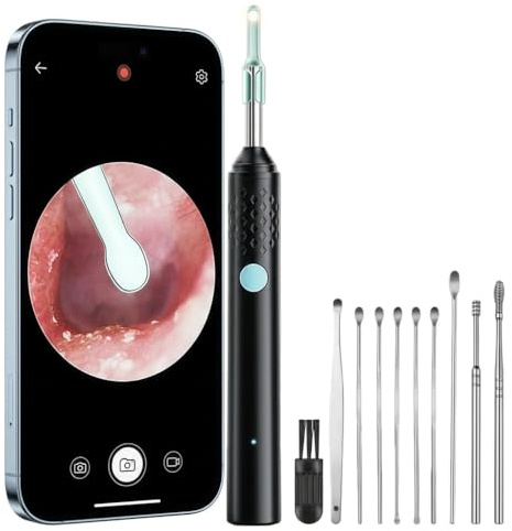 Earo Oreille - Earo Vision 2.0 2026 Nettoyeur Oreille Camera Connecte Compatible Smartphones Tablettes Adultes Enfants (Noir + ensemble de 9 pièces)