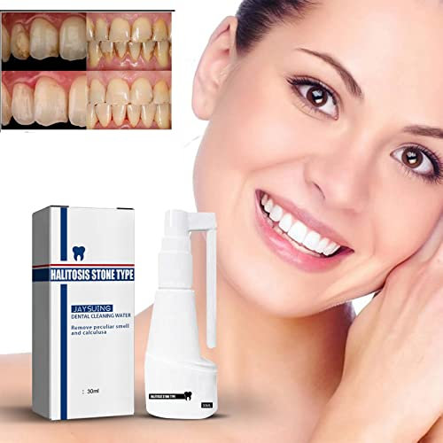 Grindrom Spray dentale dissolvente senza calcoli, Spray rinfrescante per la bocca, Detergente per denti per rimuovere il tartaro, Dentifricio intensivo per la rimozione delle macchie (3 pezzi)