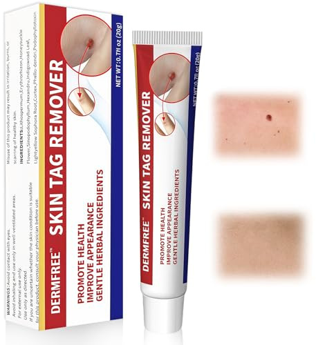 20g Crema para de Quita verrugas,Crema reparar,Para Áreas de Piel Irregularidades en Manos y Cuerpo