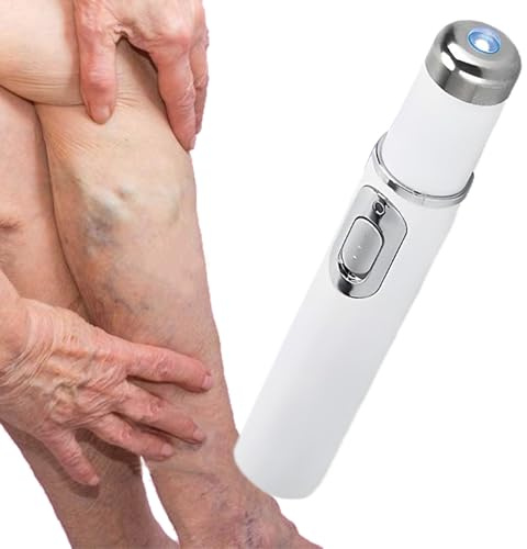 Penna Rimozione Capillari – ABS E Componenti Elettronici 1.9x13.5cm | Strumento Non Invasivo Per Cura Delle Vene | Dispositivo Wireless Per Trattamenti Domestici Di Bellezza | Rimuovi Macchie Elettric