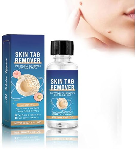 Azote Liquide Verrue Remover, pour enlever les verrues sur les mains et le corps, rapide pour enlever les verrues, adapté à toutes sortes de peaux (30ml)