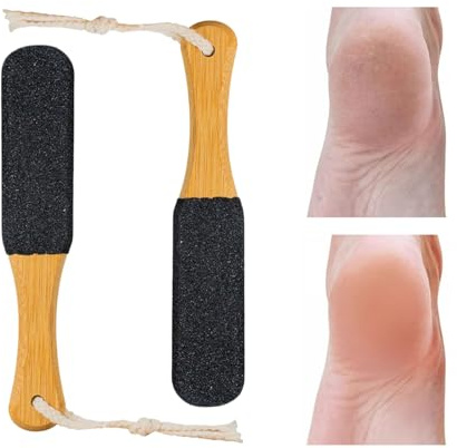 Professionellt set med hornhudfilar – dubbelsidig fotrasp, pedikyrskrubbningsverktyg, hälvård behandlingsset för att ta bort död hud, robust fotskrubb skrapa vård verktyg för
