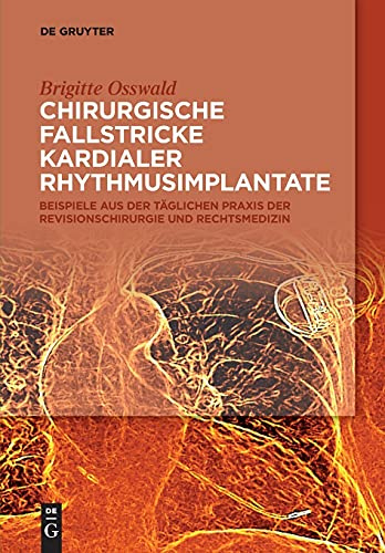 Chirurgische Fallstricke kardialer Rhythmusimplantate: Beispiele aus der täglichen Praxis der Revisionschirurgie und Rechtsmedizin