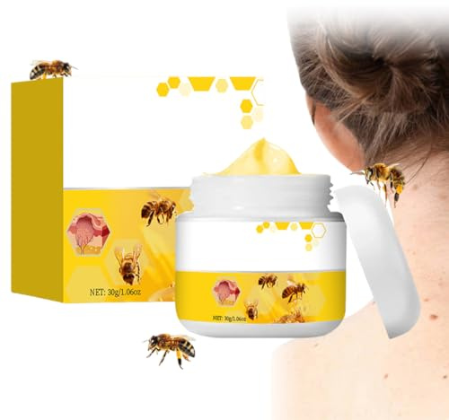Crema al Veleno d'Api per Verruche e Nei - Naturale con Bee Venom - Rimuove in Modo Sicuro - 30g