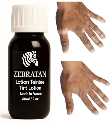 Anpassad vitiligo makeup - 60 ml djup brun - självbrunnande lotion - kamouflage fläckar