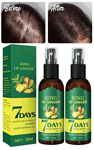 XIRUJNFD Shouga Kingu Hair Growth Oil, King Of Ginger 7 Days Hair Growth, Shougagro Japanese Hair Growth Spray, Ginger Oil For Hair Growth, Anti-Hair Loss Oil (2Pcs)