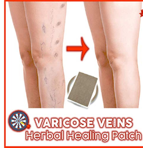 Varicose Veins Herbal Healing Patch Original Quality (24PCS)