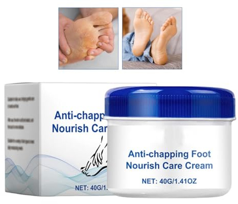 Crema per i piedi, lenitiva per i diabetici, cura e cura i piedi secchi, crema idratante per talloni, per uomini e donne