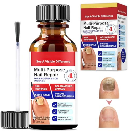 Tratamiento Uñas Pies, Reparadores de Uñas Solución, Cuidado Uñas Dañadas, Fortalece la Uña, La Uña se Regenera de Forma Natural, Restaura el Aspecto Natural de Las Uñas, 30ml, Rojo