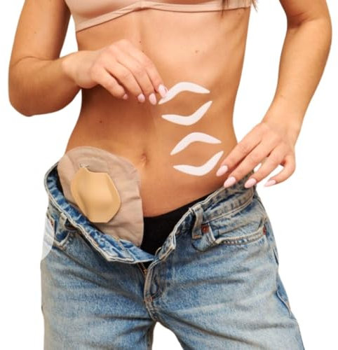 SIIL Scudo per stomia | Stoma Guard | Protezione per stomia Ostomy | Accessori per stomia | Copri sacca per stomia | Beige