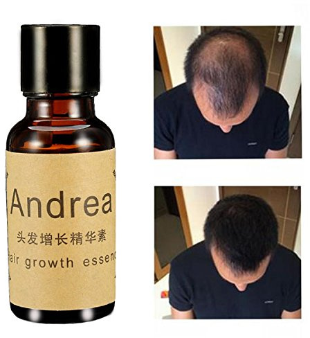 LM Líquido crecepelo, esencia para un rápido crecimiento del pelo, para hombres y mujeres, 20 ml