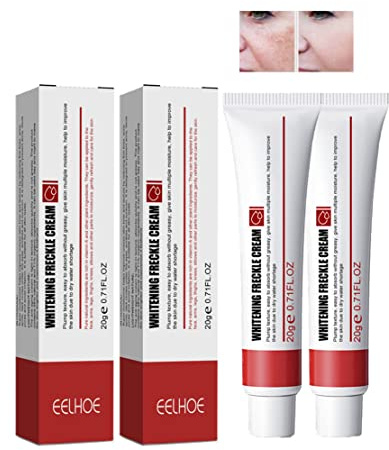 2 Pz Crema Sbiancante Per Lentiggini, Crema Per La Rimozione Delle Cicatrici Da Acne, Rimozione Delle Macchie Scure Da Melasma, Crema Per Lo Sbiancamento Della Pelle (2 Anti-Blemish Cream)