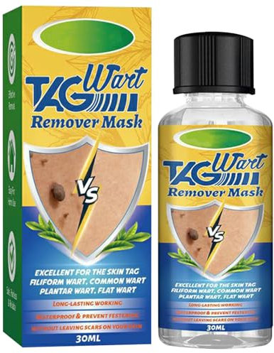 Azote Liquide Anti-verrues - 30ml Acrochordons Traitement Efficace, Azote Liquide Anti-verrues, Acrochordons, Traitement DesVerrues Plantaires Et Génitales, Pour Les Types De Peau