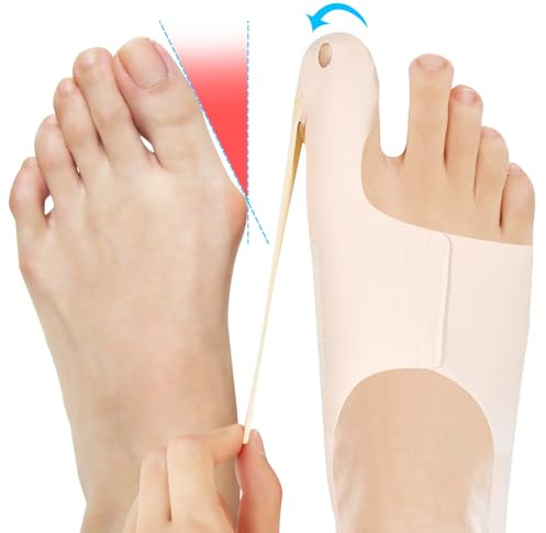 SOARFLY Hallux Valgus Korrektur, Verstellbar Hallux Valgus Schiene, Hallux Valgus Bandage,mit Rutschfestem Fersenriemen, Linderung von Schmerzen bei Hallux Valgus, für Fußprobleme,Tag & Nacht (L)