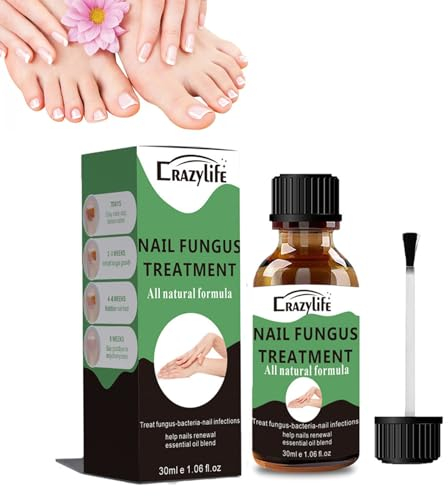 Nagel oil- Extra starke Nagel oil für Fuß- und Fingernägel Einwachsen Zehennagel Nagelpflege Serum für Brüchige, Nagelpflege Nagellack, auch bei Nagelverfärbungen, Schöne Maniküre, 30ml