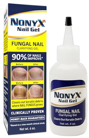 Xenna All Natural NonyX Nail Gel, For Toenails and Fingernails - 4 oz