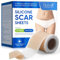 Silicone Scar Sheets 1.6×60 - Medical-Grade Silicone Tape for Scar Removal, C-Section, Surgery, Keloid, Acne, Burn – Reusable, Breathable, Cuttable Scar Tape