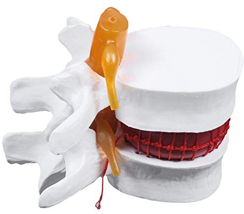 Katigan Human Anatomia Scheletro Spinale Lombare Disco Ernia Insegnamento Modello Cervello Cranio Traumatico Materiale Scolastico Forniture Mediche