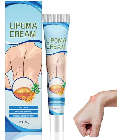 Crema per la rimozione del lipoma, 20g, Crème de soin per la rimozione di Nodi di Grasso e grumi, Per La Cura Della Linfa