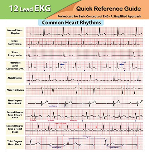 12 Lead EKG Pocket Card
