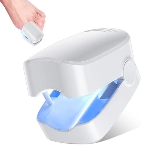 Appareil Traitement Laser Mycose Ongles, Mycose Ongles des Pieds Nettoyage et Réparation Ongles, Traitement Champignons Ongles,7 Minutes par Jour - Ne Soyez Plus Gêné