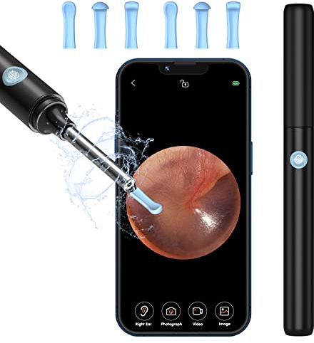 Ohrenschmalz Entferner Otoskop, VITCOCO Ohrenreiniger Kamera, 5MP HD Ohr Kamera IP67 Wasserdicht Ohr Reinigung, Wifi Ear Cleaner Camera mit 6 LED Leuchten Ohr Endoskop für iPad, iPhone & Android