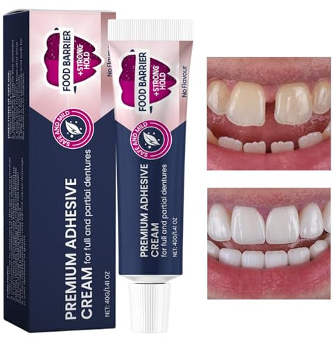 Denture Adhesive - 40g Adhesive for Dentures | Long Holding Denture Reliner | Thermoplastic Denture Adhesive Cream | Glue for Dentures Refits and Tightens Loose Upper & Lower Dentures Partials