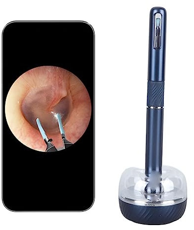 Herramienta de Eliminación de Cera de Oídos, Limpiador de Oídos con Cámara y Luz LED, Otoscopio de Cámara de Oído, Removedor de Cera de Oídos de Gran Angular de 10 MP y 360 Grados (Azul)