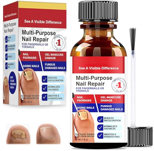 30ml Reparadores De Uñas Solución, Tratamiento De Uñas Los Pies, Pueden Calmar Y Nutrir Las Fortalece La Uña, Cuidado Diaria Y Mejora Aspecto, Para Decoloradas Los Pies