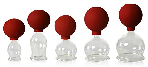 Lauschaer Glas 5er Schröpfglas-Set mit Ball 30-40-50-60-70mm zum professionellen, medizinischen,feuerlosen Schröpfen mundgeblasen, handgeformt, Schröpfglas, Schröpfgläser, Origina