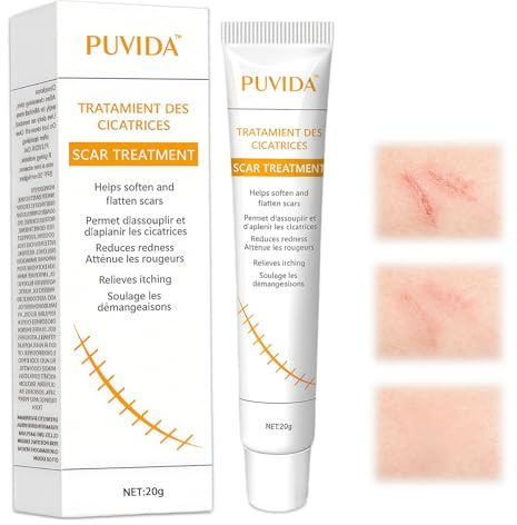 20g Cicatrice gel, Baume pour cicatrices, Crème apaisante, Favorise la réparation des peaux abîmées et asséchées, pour une peau plus lisse et apaisée avec usage régulier