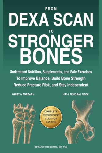 From DEXA Scan to Stronger Bones: Understand Nutrition, Supplements, and Safe Exercises to Improve Balance, Build Bone Strength, Reduce Fracture Risk, and Stay Independent