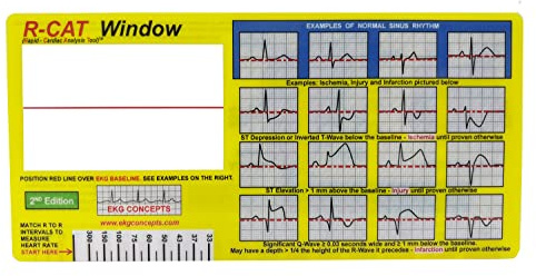 R-CAT ECG Card (EKG) Finestra Strumento ECG per paramedici, Infermieri e Medici