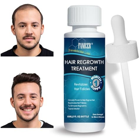 60ml Siero Capelli, Favorisce la Ricrescita Naturale e Rafforza le Radici, Per Tutti i Tipi di Capelli,Rendere i Capelli Più Folti, Uomo e Donna