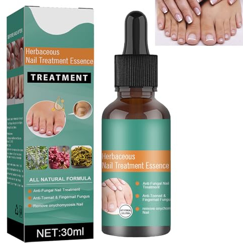 Soluzione per la Cura Delle Unghie,Fungo Unghie Piedi,Trattamento Unghie,Cura delle Unghie,Soluzione per La Riparazione delle Unghie del Piede,Liquido per Infezione delle Unghie 30ml