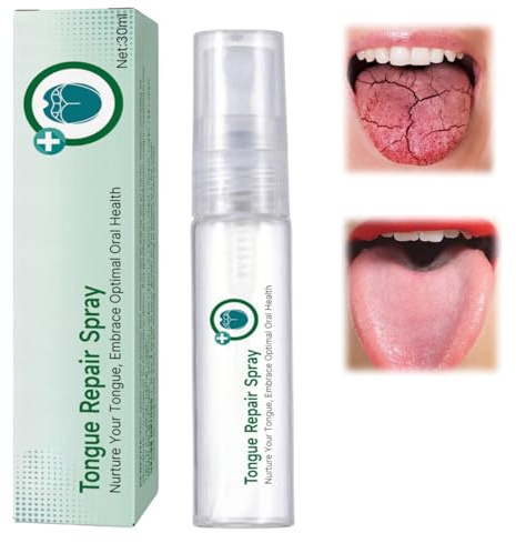 Tongue Repair Spray,Moisturizing Dry Mouth Spray,Fissured Tongue Relief Spray,Instant Dry Mouth Relief,Breath Freshener Spray for Tongue Relief,Tongue Relief Treatment,for White Coating/Bad Breath
