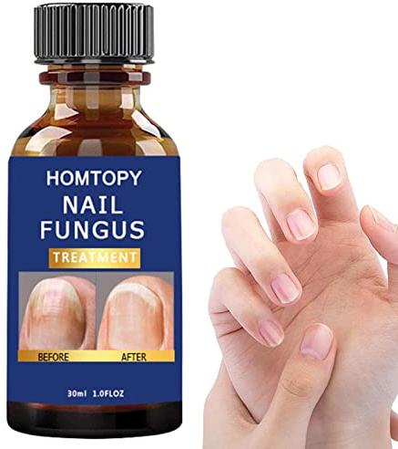 JINGAN Fortalecedor de uñas, Kit de reparación de uñas para uñas Naturales agrietadas, El endurecedor de uñas Protege Las uñas de astillas, rajaduras, peladuras y roturas para uñas Finas y agrietadas