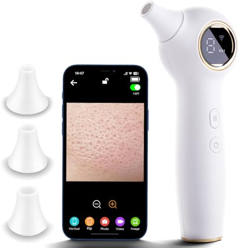 RONEFY Extractor de puntos negros con cámara, removedor de cabeza negra para cara, extractor de poros para cabeza negra y acné, herramientas de eliminación de puntos negros con recargable por USB,