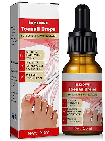 Eingewachsene Zehennägel Behandlung - 30ml Eingewachsene Zehennägel - Nagelhautpflege Öle für eingewachsene Zehennägel