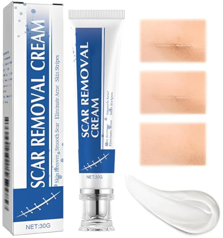 DOVBAN 30g Ayuda a Reducir La Apariencia Antiguas y Nuevas,Crema Para El Cuidado De La Piel,Des Para Cara y Cuerpo