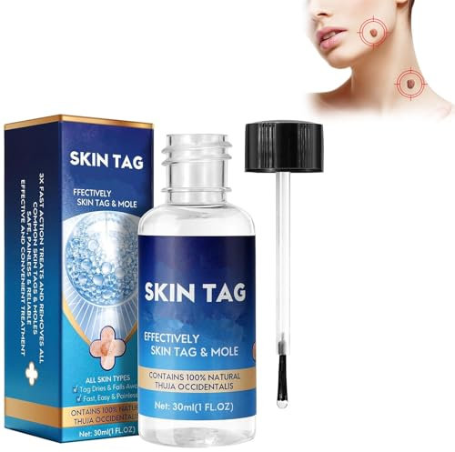 Liquide Anti Verrues,Liquide D'élimination Des Verrues,30ml Sérums D'élimination Des Acrochordons,Élimination Des Verrues Plantaire,Pour Les Types De Peau